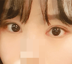 我的眼睛变得完美了！
