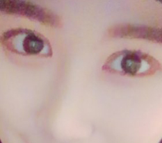Review of liposuction, eyes, and nose