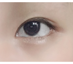 告别小眼睛