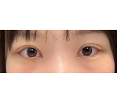 My eyes opened up so nicely lol