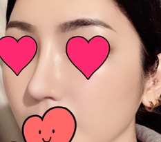 留下修复手术评价~*_*