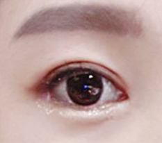 我想承认这是眼修复名店