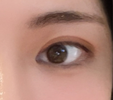 手术很成功