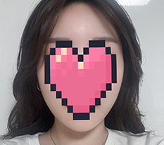 鹅蛋脸♥