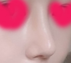 身边朋友看到我的鼻子都炸了哈哈