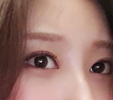 眼部整形果然还是现代美学~