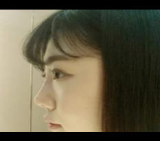 鼻部填充超赞