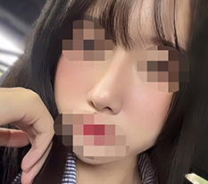 解决低鼻问题