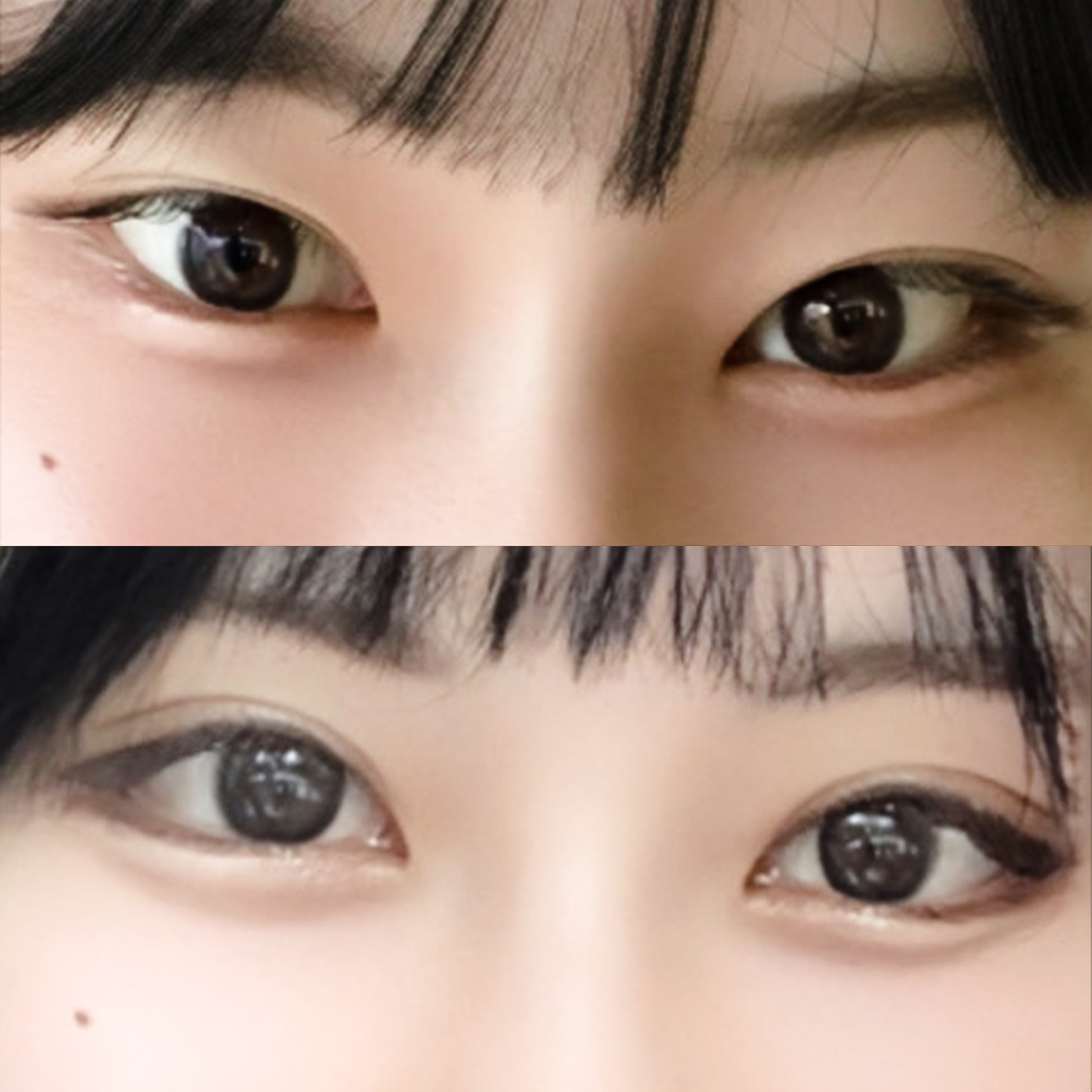 眼修复加双重开眼角后变温顺的眼神