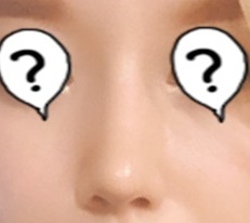 My unattractive nose changed my whole image after rhinoplasty at 现代美学整形外科!
