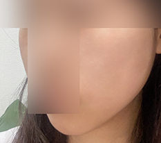 终于来写轮廓针评价!
