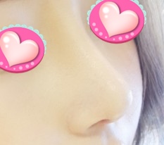 正面侧面都很满意，开心哈哈哈哈