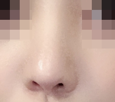 尖尖的鼻头变柔和了!