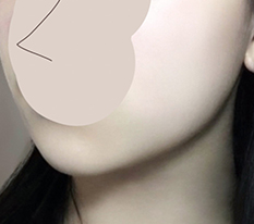 下巴肉整理完成
