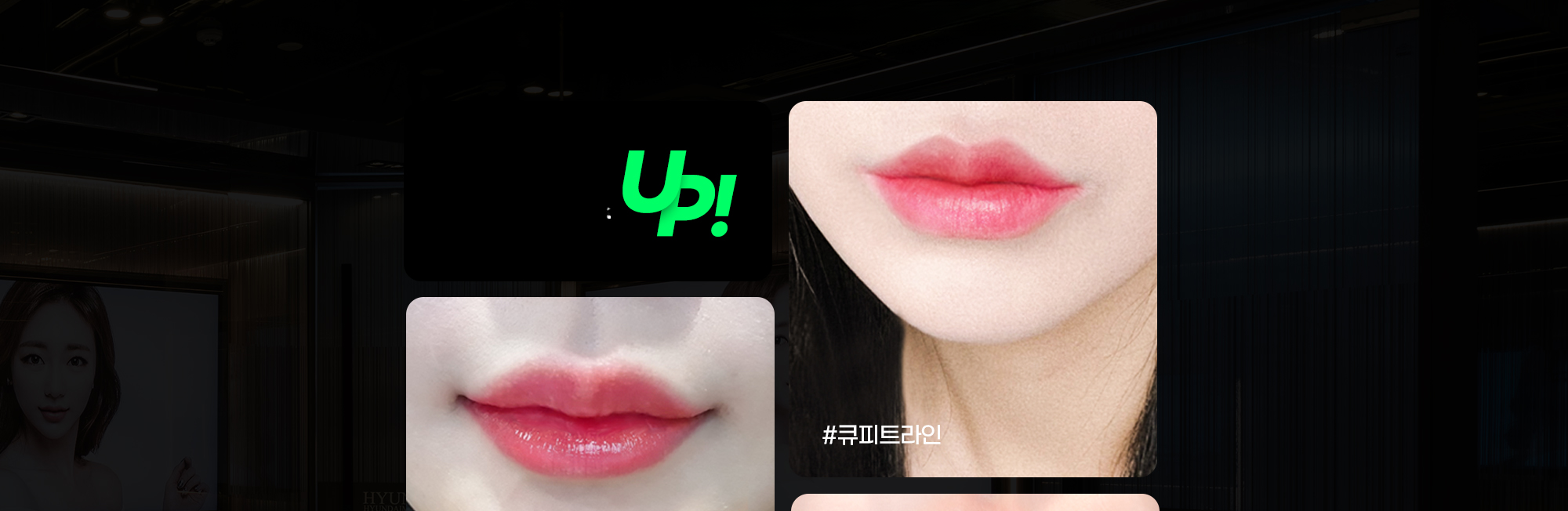 Cupid线唇部整形前后唇部照片